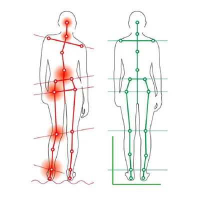 TMS : pourquoi regarder les pieds pour comprendre les épaules